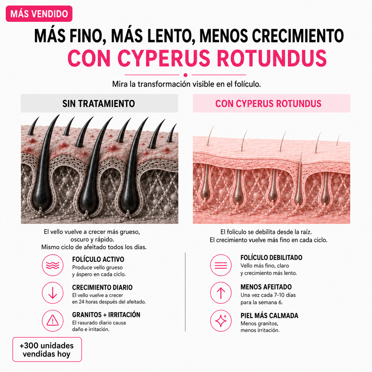 Serum para frenar el crecimiento del vello