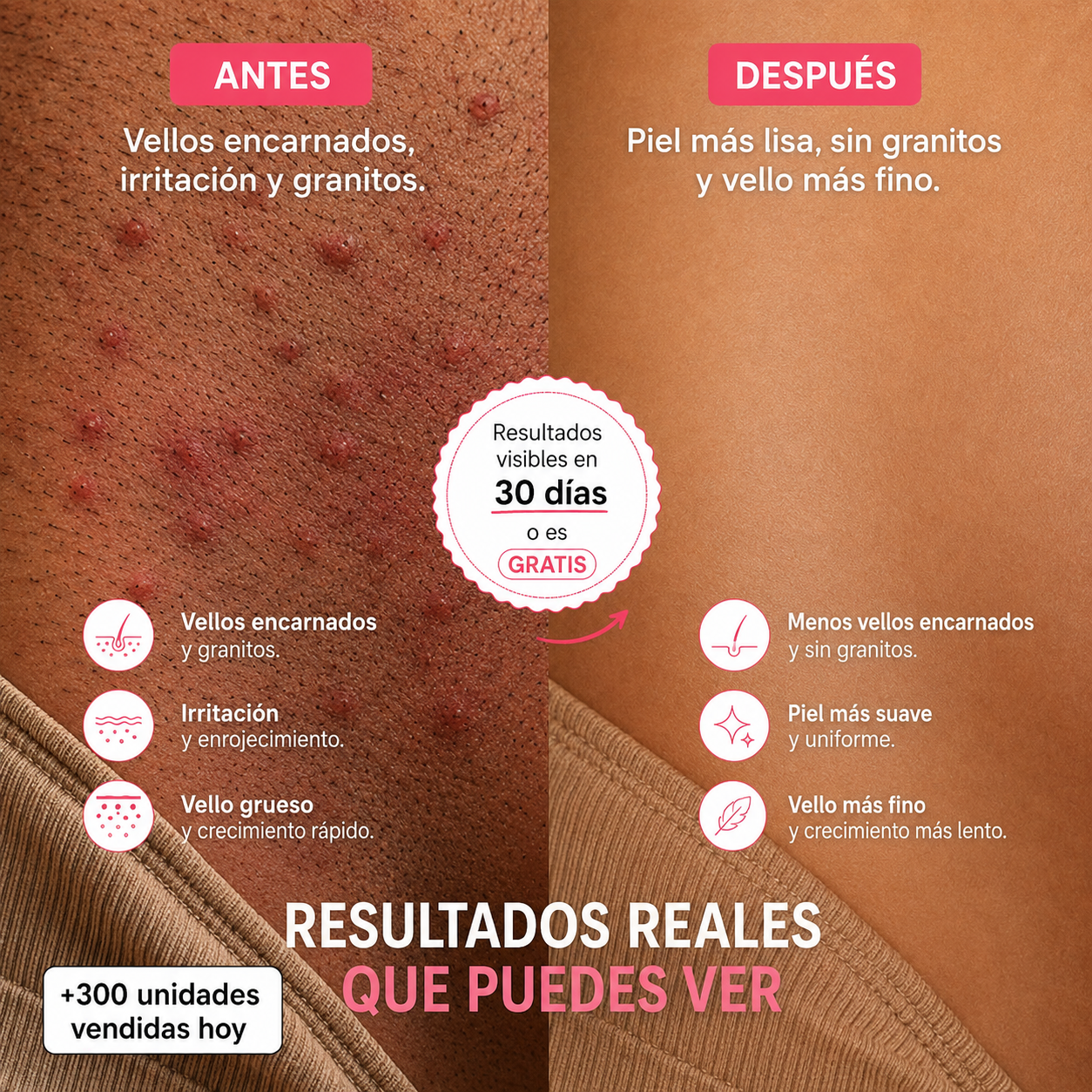 Serum para frenar el crecimiento del vello