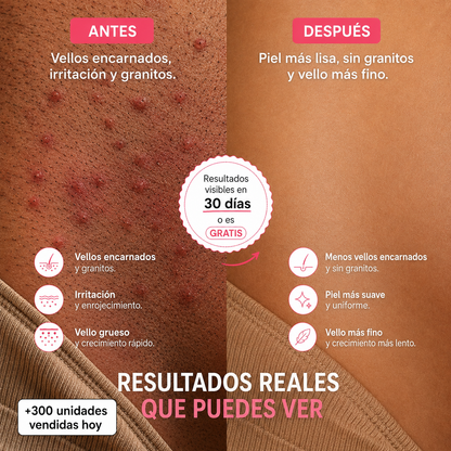 Serum para frenar el crecimiento del vello