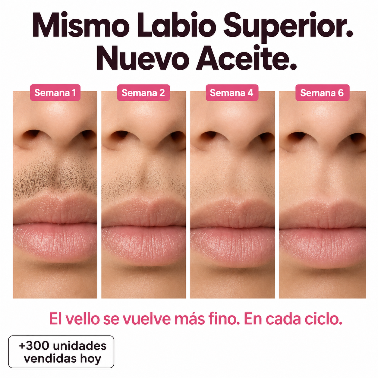Serum para frenar el crecimiento del vello