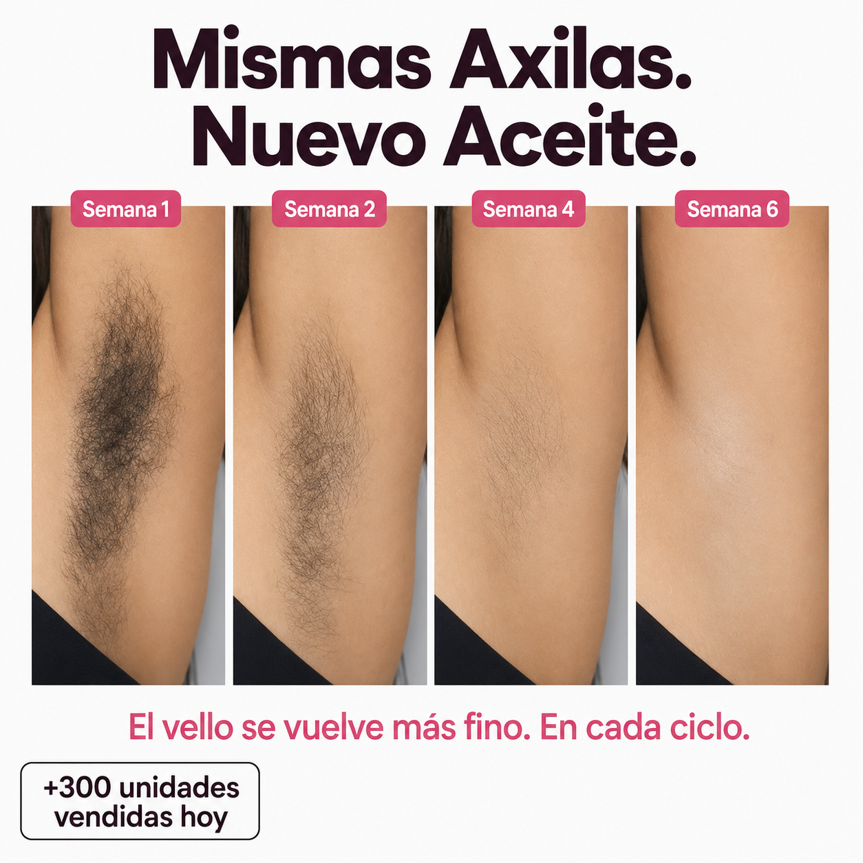 Serum para frenar el crecimiento del vello
